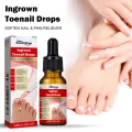 South Moon Inner Toenail Repair Serum, Nail Repair Nail Care, Nail Care, Essential Oils, Cleanse and Remove Nail Fungus. 
