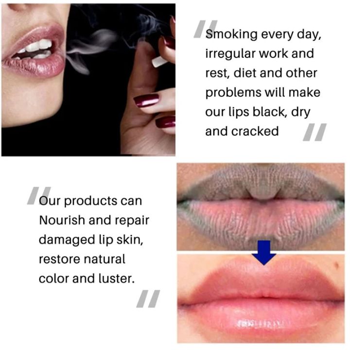 Lipstick%20Lip%20Gloss%20Repair%20Dry%20And%20Cracked%20Lips%20Moisturize%20And%20Moisturize%20To%20Remove%20Dark%20Lips%207G%20A%20Box%20For%20Men%20And%20Women%20Lip%20care%20Vnce%20Lncei%20-%20Image%202
