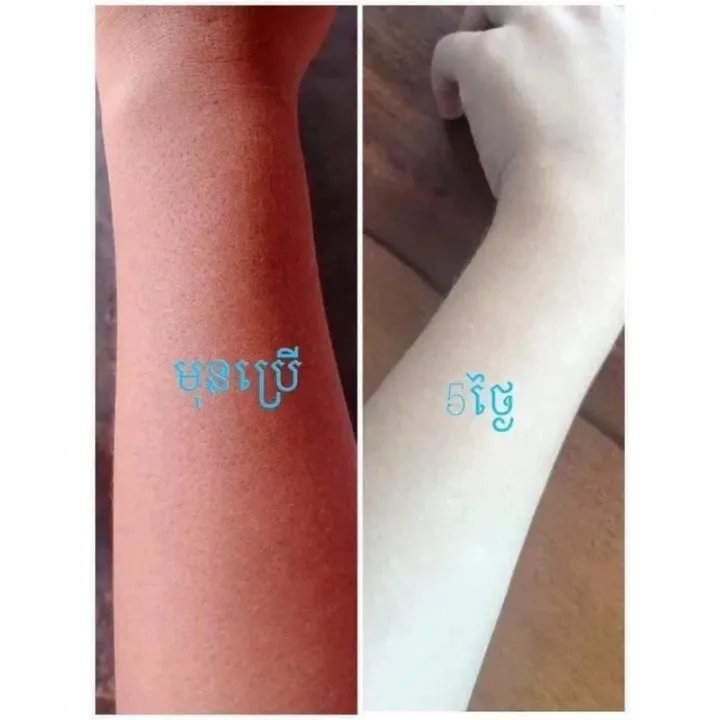 New%20Cream%20Body%20Vip%20Black%20Peeling%20Essence,%20Helps%20the%20skin%20to%20absorb%20the%20best%20and%20fastest%20whitening%20cream%20Genuine%20300g%20-%20Image%202