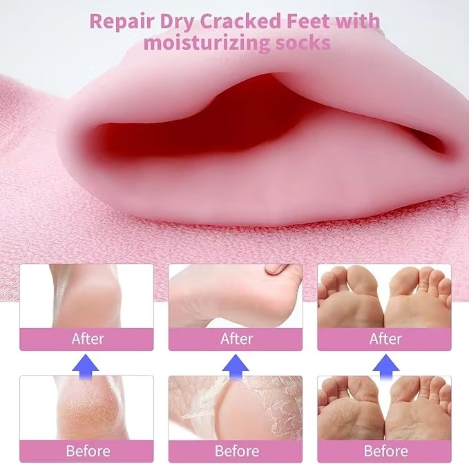 Spa%20Gel%20Socks%20for%20Dry%20Feet%20%E2%80%93%20Soft%20Silicone%20Heel%20Protector%20&%20Callus%20Remover%20-%20Image%203