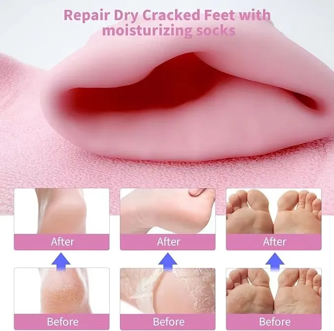 Spa%20Gel%20Socks%20for%20Dry%20Feet%20%E2%80%93%20Soft%20Silicone%20Heel%20Protector%20&%20Callus%20Remover%20-%20Image%202