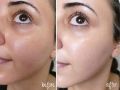 Beaute Melasma-X Glutathione B r i g h t e n i n g Tone Up Cream 45ml / Beaute Melasma-X 3D W h i t e n i n g Clinic Renewal Cream 40gm. 