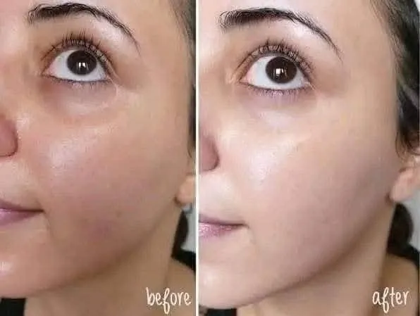 Beaute%20Melasma-X%20Glutathione%20Brightening%20Tone%20Up%20Cream%2045ml%20-%20Image%206