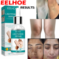 Retinol EELHOE Dark Parts Dark Underarm and Bikini Areas Whitening Anti Wrinkle Moisturizing Makes Your Private area Clean And White. 