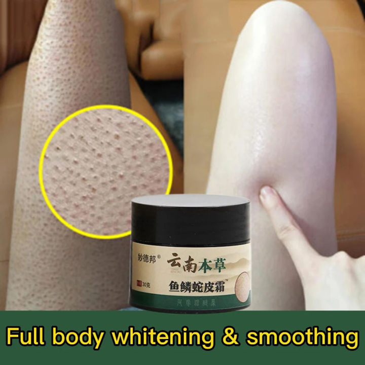 Coarse body hair, removal, cyst removal, Pila, good cream, keratosis, hairy chicken, skin condition, hole modification, dark spots, moisturizing, whitening, smooth skin care