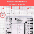 NCANRUI 2pc ECG 7 Step Ruler,ECG 7 Step Ruler for ECG/EKG Interpretation, ECG Reference Guide Ruler,EKG Calipers Measuring Tool.