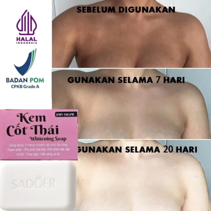 Turmeric%20&%20Kojic%20Acid%20Kem%20Cot%20Thai%20Whitening%20Soap%20-100gm%20Premium%20-%20Image%208
