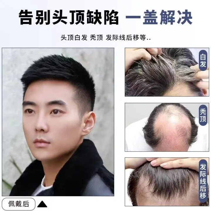 Wig%20men%20s%20short%20hair%20Korean%20version%20handsome%20head%20replacement%20hair%20weaving%20men%20s%20real%20hair%20bald%20high%20forehead%20breathable%20-%20Image%207