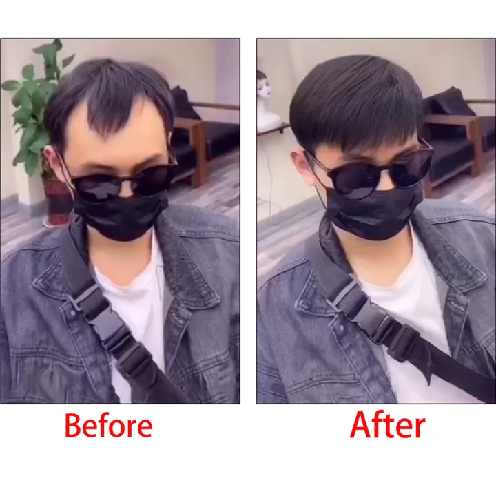 Front%20Men%20Toupee%20Human%20Hair%20Piece%20For%20Men%20V%20Style%20Front%20Toupee%20Wig%20Remy%20Hair%20Thin%20Skin%20Base%20Natural%20Hairline%20Toupee%20And%20Tapes%20-%20Image%206