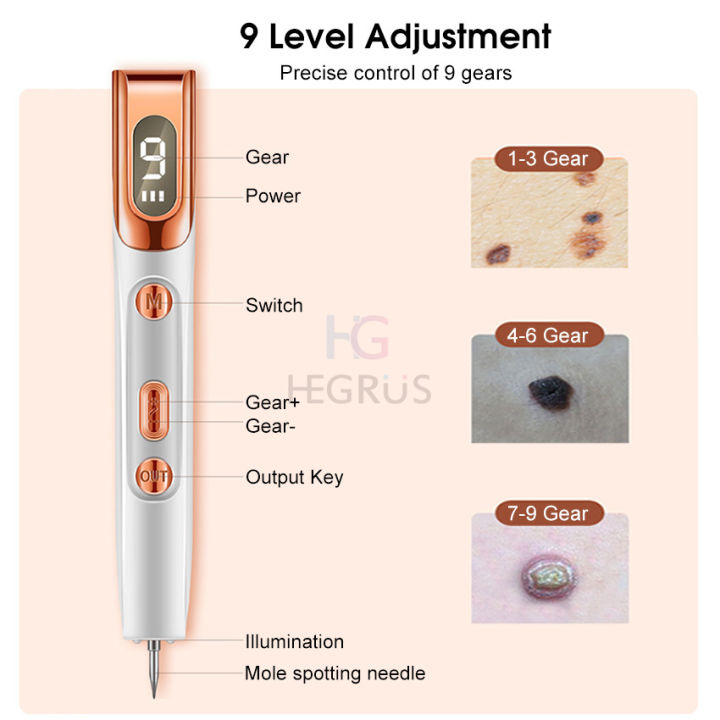 New%20HEGRU%20Mole%20Removal%20Pen%20kin%20Tag%20Remover%20pot%20Tattoo%20Freckle%20Removal%20Pen%20LED%20Lighting%20weep%20pot%20Mole%20Removing%20Dark%20pot%20Remover%20kin%20Care%209%20Adjutable%20Mode%20Laer%20Mole%20Pen%20-%20Image%205