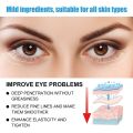Caffeine eye cream reduces fine lines, moisturizes and repairs eye bags, tightens and moisturizes the skin around the eyes.