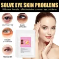 Micro-needle Eye Patch Hyaluronic Remove Dark Circles Eye Bags Improve Puffiness Lift Firm Whitening Moisturizing Skin. 