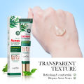 SADOER Tea Tree Oil Control Anti-Acnes Gel- 20g. 