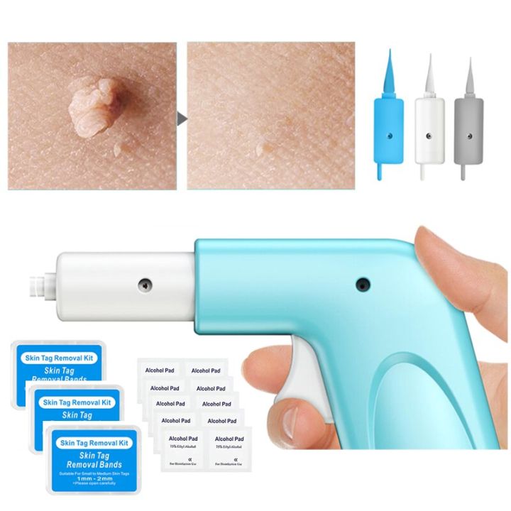 3 In 1 Auto Skin Tag Remover Painless Mole Wart Removal Kit Device Professional Verrugas Eliminar Face Care Beauty Tool Home Use