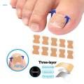 【Top-rated】 Toenail Corrector Stickers, Toe Nail Treatment Toe Nail Care Correction Tool - 50 Sheets. 