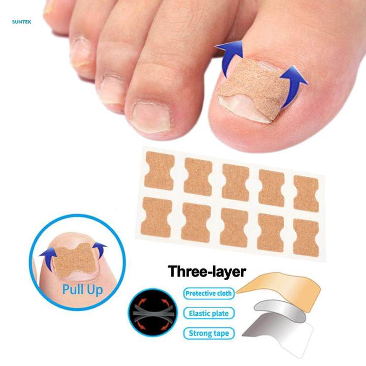 %E3%80%90Top-rated%E3%80%91%20Toenail%20Corrector%20Stickers,%20Toe%20Nail%20Treatment%20Toe%20Nail%20Care%20Correction%20Tool%20-%2050%20Sheets%20-%20Image%208
