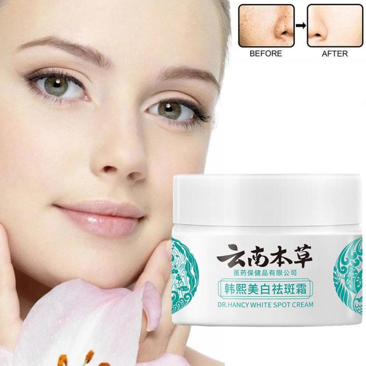 20g%20YunNan%20Herb%20Whitening%20Freckles%20Cream%20Remove%20Melasma%20Fade%20Dark%20Spots%20Shrink%20Pores%20Brightening%20Anti-aging%20Skin%20Care%20Product%20-%20Image%204