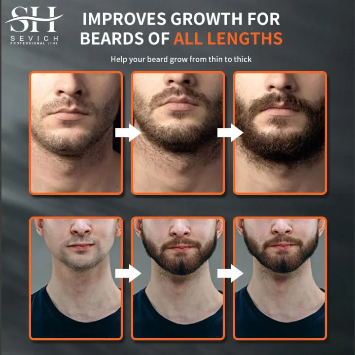 %E3%80%90LuckyBabyFans%20Store%E3%80%91Beard%20Oil%20Promotes%20Beard%20oil%2030ml%20-%20Image%202