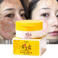 Astragalus Whitening Freckle Face Cream Effective Remove Dark Spots Fade Melasma Melanin Moisturizing Brighten Dull Skin Care. 