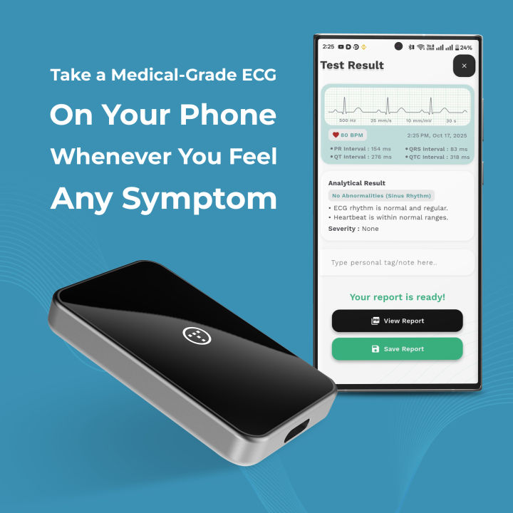 myECGai (Basic)| Portable ECG Machine | Medical Grade Single Lead ECG ...