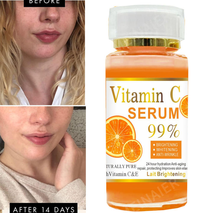 120ml%2099%25%20Vitamin%20C%20Serum%20Oil%20Facial%20Serum%20AHA%20Kojic%20Acid%20glutathione%20Facial%20skin%20brightening%20-%20Image%202