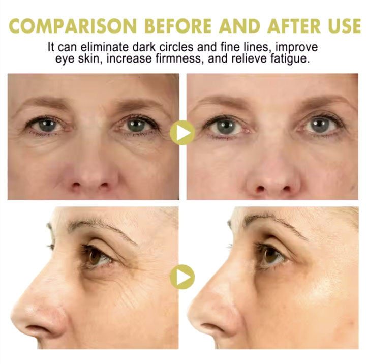 Ouhoe%20Anti%20Wrinkle%20Snail%20Peptide%20Eye%20Care%20Cream%20Stick%203gm%20Reduces%20Dark%20Eye%20Circles%20and%20Fine%20Lines%20-%20Image%203