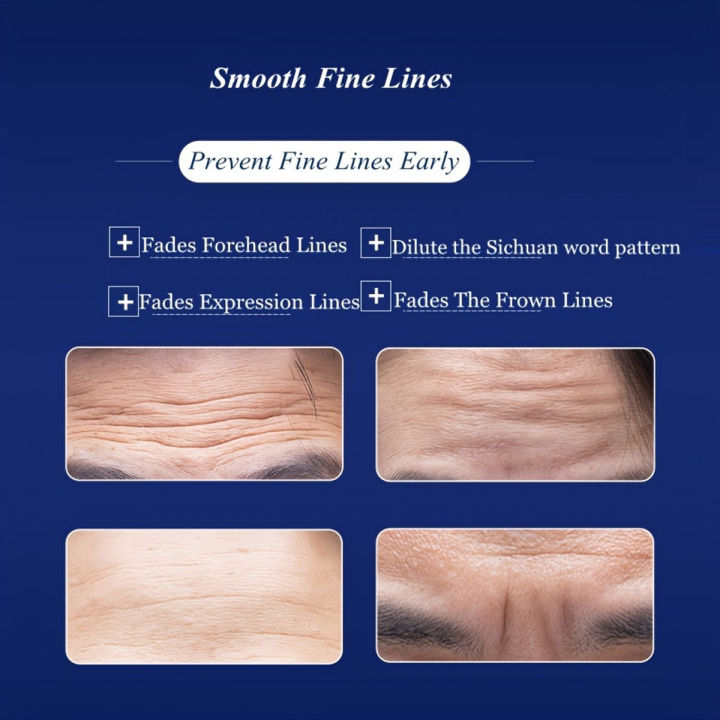 Ilisya%20Wrinkle%20Forehead%20Patches%20for%20Men%205%20Pcs%20with%20Aloe%20Collagen%20Forehead%20Wrinkles%20Treatment%20-%20Image%203