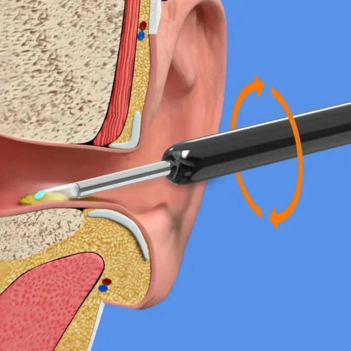 Wireless%20Wi-fi%20Visual%20Ear%20Cleaner%20Otoscope%20Ear%20Wax%20Ear%20with%201296P%20HD%20Cleaning%20Kit%20Removal%20Sticks%20Endoscope%20Camera%20Tool%20Kit%20-%20Image%205