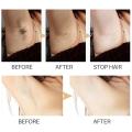 Permanent Hair inhibition Serum Painless Hair Remover Armpit Legs Arms Hair Growth Inhibitor Beauty Skin Care Body Essential Oil.