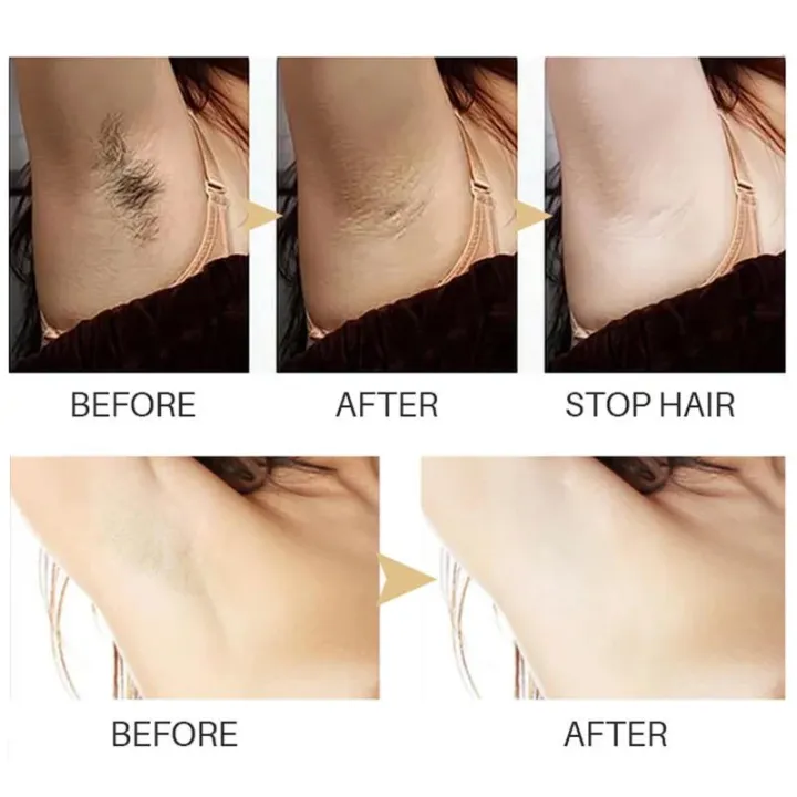 Permanent%20Hair%20inhibition%20Serum%20Painless%20Hair%20Remover%20Armpit%20Legs%20Arms%20Hair%20Growth%20Inhibitor%20Beauty%20Skin%20Care%20Body%20Essential%20Oil%20-%20Image%205