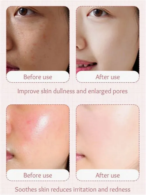 SADOER%20Hydro%20Boost%20Milk%20Peach%20Moisture%20&%20Nourish%20Serum-%2030ml%20-%20Image%205