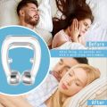 Stop Snore Nose Clip Device Easy Breathe Improve Sleeping for Men/Women Magnetic Anti Snoring Nasal Dilator. 