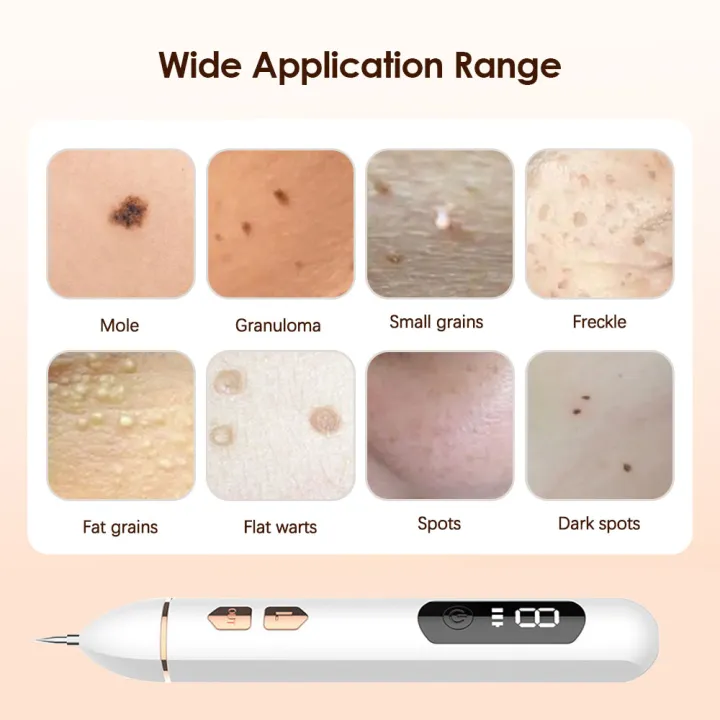 9%20Level%20Skin%20Body%20Spot%20Wart%20Tag%20Tattoo%20Removal%20Pen%20Black%20Pore%20Dark%20Spot%20Remover%20Needle%20Remover%20Point%20Pen%20Facial%20Skin%20Care%20-%20Image%205