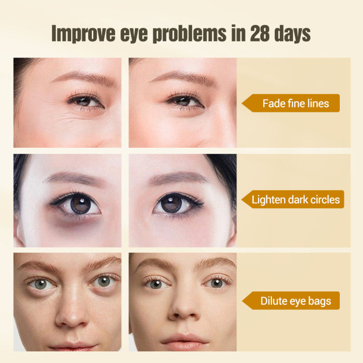5%20Pairs%20Oligopeptide%20Freeze-dried%20Eye%20Mask%20Fade%20Eye%20Bags%20Dark%20Circles%20Fine%20Lines%20Hydrolyzed%20Collagen%20Patches%20Skin%20Care%20Products%20-%20Image%203
