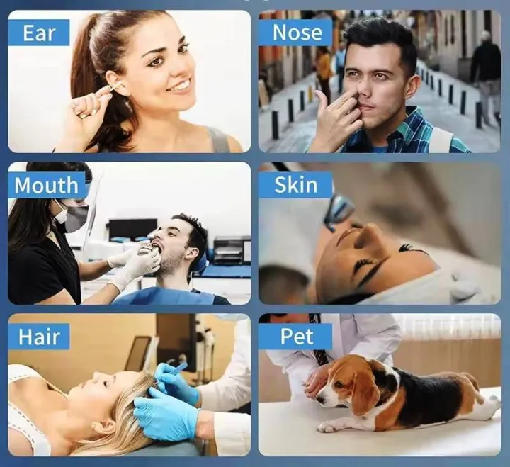 Bright,%20Clear,%20and%20Gentle%20%E2%80%93%20Smart%20Visual%20Ear%20Cleaner%20with%20HD%20Camera%20%E2%80%93%20Safe,%20Precise%20&%20Rechargeable%20Ear%20Care%20Solution%20-%20Safe,%20Precise%20&%20Hygienic%20Ear%20Cleaning%20-%20Image%206