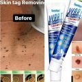 Warts & Skin Tag Remover Ointment: Treatment Cream. 