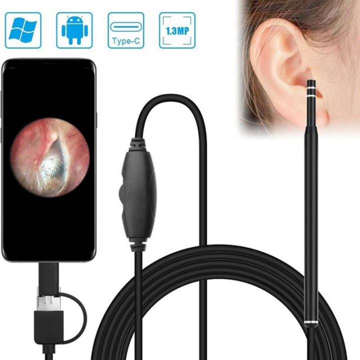 Ear%20Cleaning%20Camera%20Otoscope,%20Endoscope,%203%20in%201%20Ear%20Wax%20Removal%20-%20Image%205