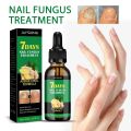7DAYS Repair Nail Fungus Treatments Essence Foot Care Serum Toe Nails Fungal Removal Gel Anti-Infection Onychomycosis Care Tool. 