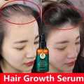 100% Natural Ginger Hair Serum Hair Grower Fast Long Hair Treatment Minoxidil Hair Grower Castor Oil For Essence Preventing Baldness Consolidate Hair Loss Treatment repairs the hair improves hair loss hair growth serum 10 x faster. 