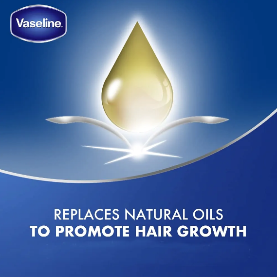 Vaseline%20Hair%20Tonic%20&%20Scalp%20Conditioner%20300ml%20-%20Image%205