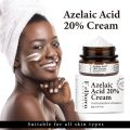 Remove Melasma Azelaic Acid 20% Whitening Fades Acne Cream Freckle Dark Pigment Spots Melanin Alpha Arbutin Face Cream Skin Care. 