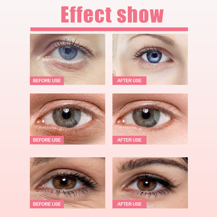 Facial%20Firmness%20Eye%20Cream%20Stick%20Reduces%20Fine%20Lines%20Removes%20Periorbital%20Dark%20Circles%20Lift%20Tightens%20Moisturizing%20Eye%20Skin%20Care%20-%20Image%205