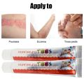 15g Chinese Medicine Psoriasis Ointment Treat Fungal Dermatitis Antipruritic Dressing Skim Eczema Antibacterial Repair Ointment. 