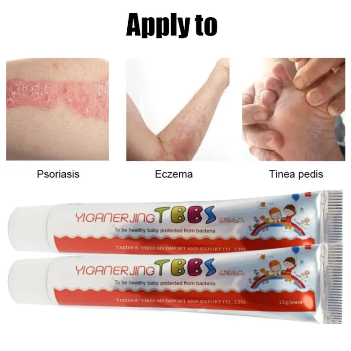 15g%20Chinese%20Medicine%20Psoriasis%20Ointment%20Treat%20Fungal%20Dermatitis%20Antipruritic%20Dressing%20Skim%20Eczema%20Antibacterial%20Repair%20Ointment%20-%20Image%204