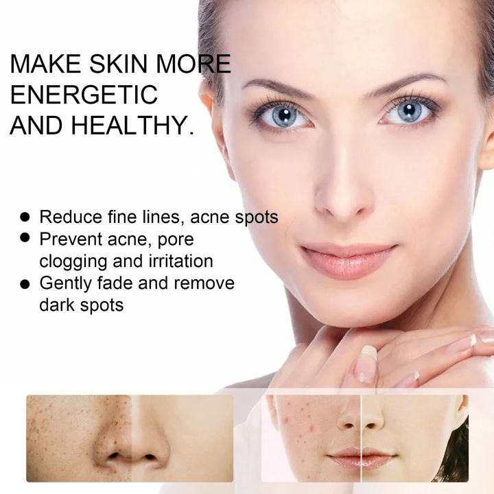 Aloe%20Vera%20Gel%20Anti%20Acne%20Treatment%20Pimples%20And%20Acne%20Remover%20Cream%20Facial%20Moisturizer%20Glowing%20Skin%20Korean%20Skin%20Care%20Products%2020g%20-%20Image%203