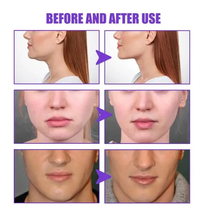 Face%20Lift%20Cream%2030g%20Double%20Chin%20Face%20Fat%20Burning%20cream%20V%20Shape%20Slimming%20Removal%20Masseter%20Face%20Tightening%20and%20Firming%20Cream%20Vnce%20Lncei%20-%20Image%205