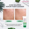 Acne Solution Serum Foam Cleanser 100ml Cathy Doll Face Wash(Made In Korea).