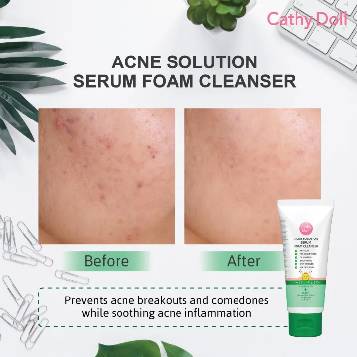 Acne%20Solution%20Serum%20Foam%20Cleanser%20100ml%20Cathy%20Doll%20Face%20Wash(Made%20In%20Korea)%20-%20Image%206