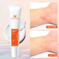 MeiYanQiong Acne Scar Remove Scar Cream Skin Repair Stretch Marks Keloid Remover Desalination Scar Face Cream Spots Effective Treatment 15g. 