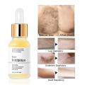 HeYang Permanent Hair inhibition Serum Painless Hair Remover Armpit Legs Arms Hair Growth Inhibitor Beauty Skin Care Body Essential Oil phone case.